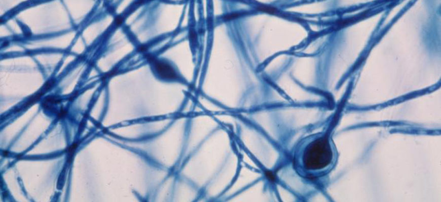 niti miceliya